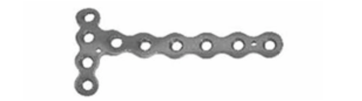 L-подібна медіальна блокуюча пластина для плато велигомілкової кістки UMP